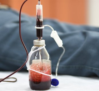 Ozon Terapi ile Kronik Yorgunluk Yönetimi